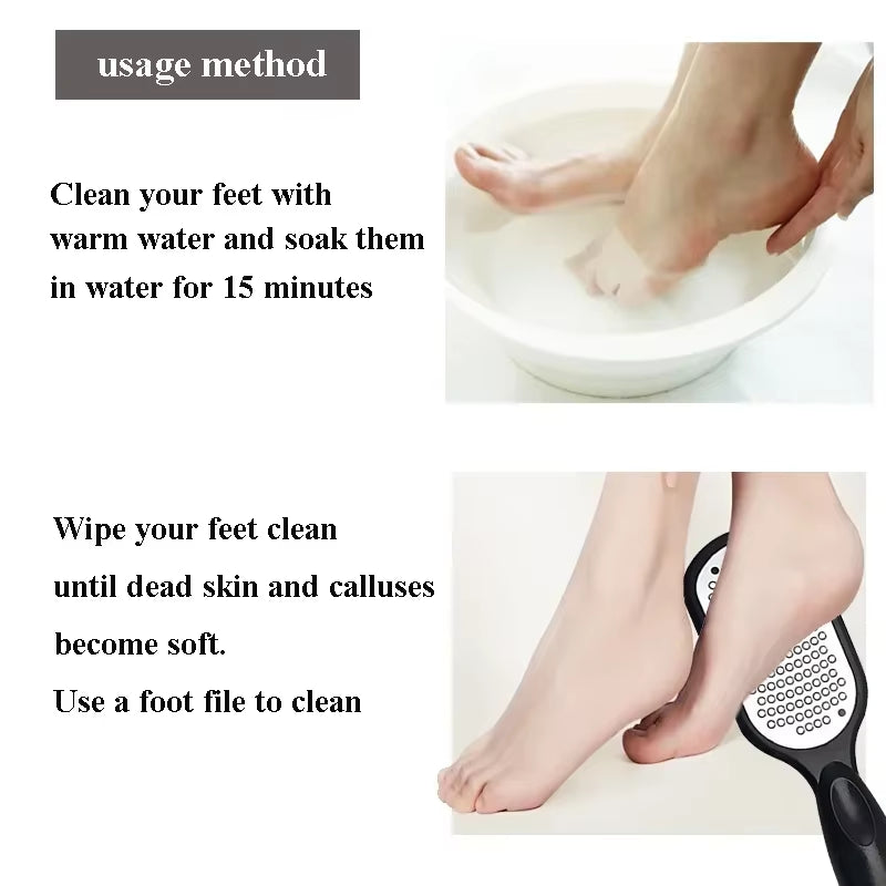 SilkyStep Pro – Double-Sided Stainless Steel Foot File for Callus &amp; Dead Skin Removal
