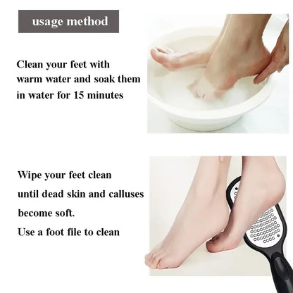 SilkyStep Pro – Double-Sided Stainless Steel Foot File for Callus &amp; Dead Skin Removal